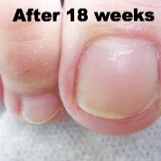 footlogix 7t nail tincture 50ml