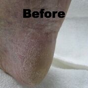 footlogix 1 dd cream mousse 125ml