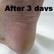 footlogix 1 dd cream mousse 125ml
